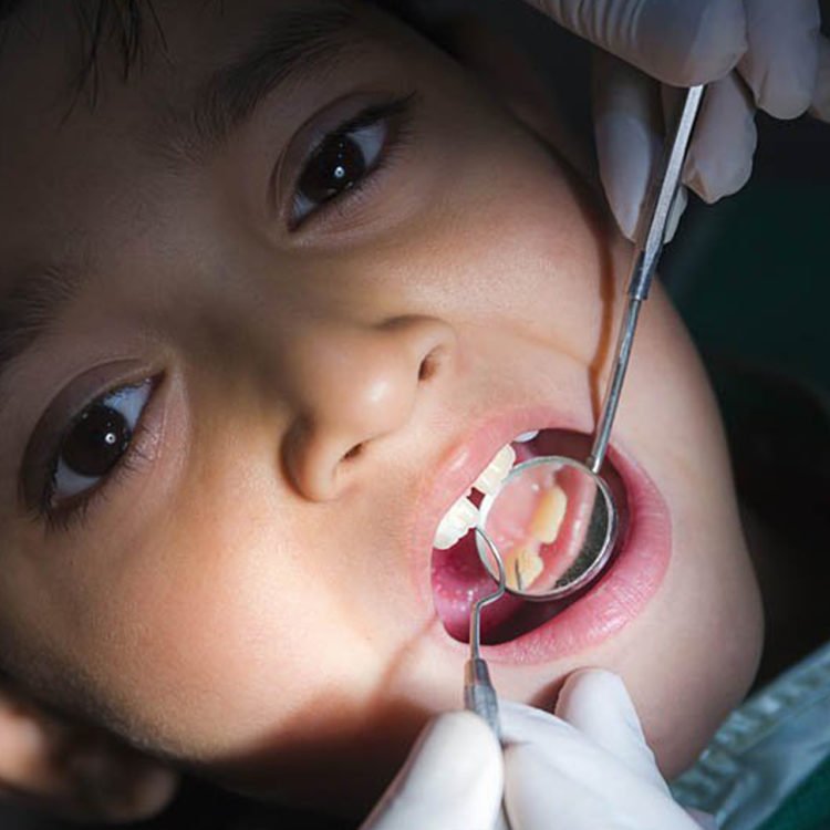 teeth oral services in agra